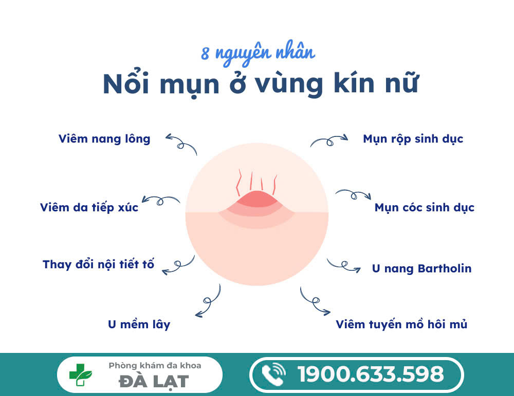 Hình ảnh minh họa